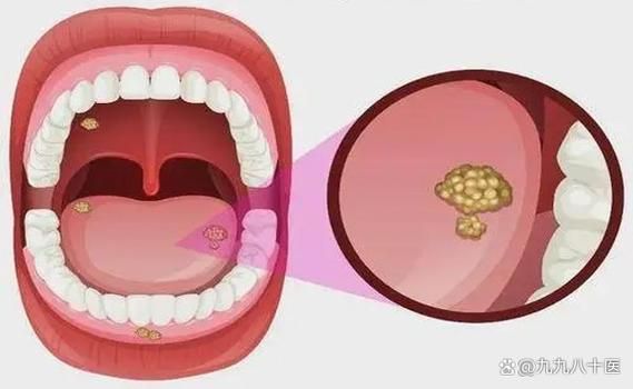 口腔疾病和口腔保健知识问答