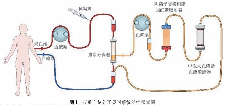 中大肝病医院治疗方法