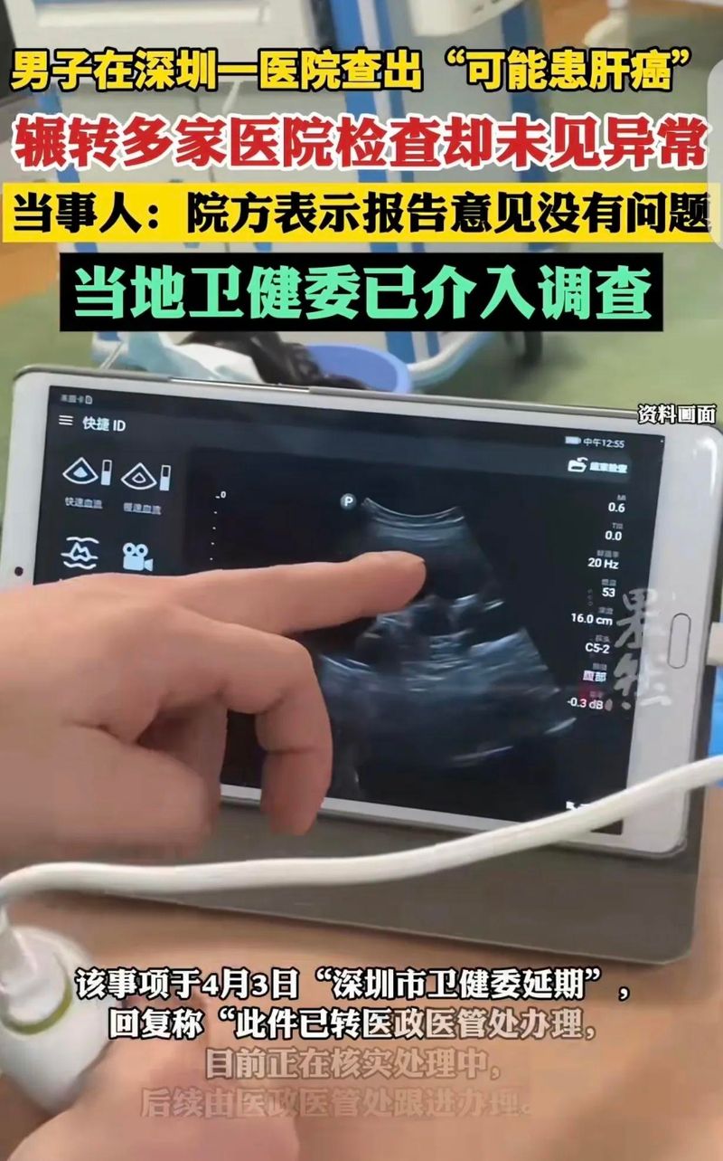中大肝病医院治疗方法