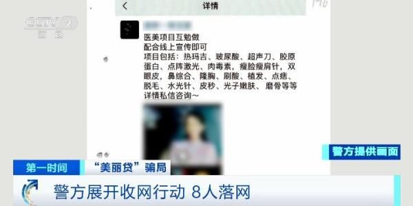 微整形瘦脸针多少钱