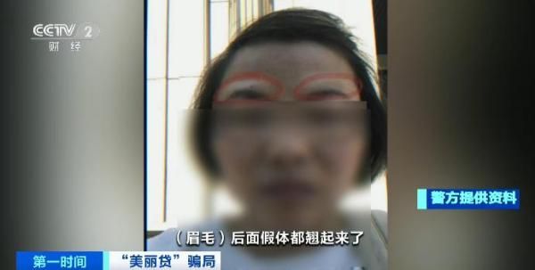 微整形瘦脸针多少钱