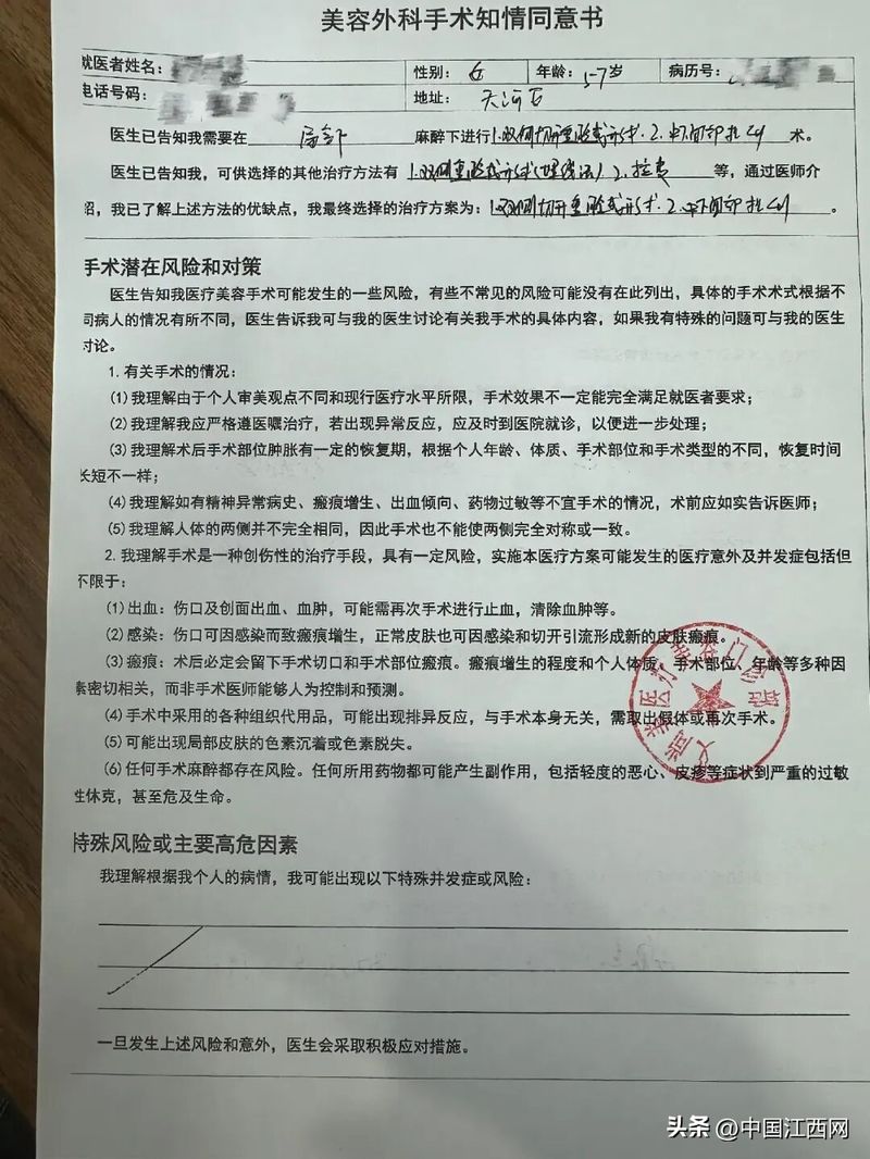 割双眼皮多少钱全隔