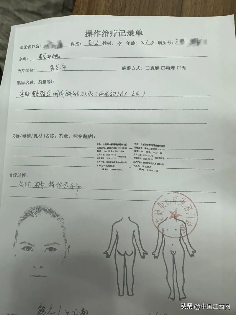 割双眼皮多少钱全隔