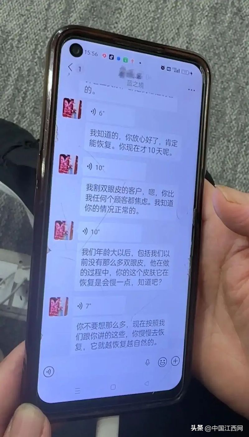 割双眼皮多少钱全隔
