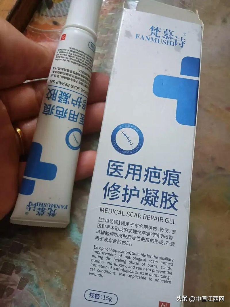 割双眼皮多少钱全隔