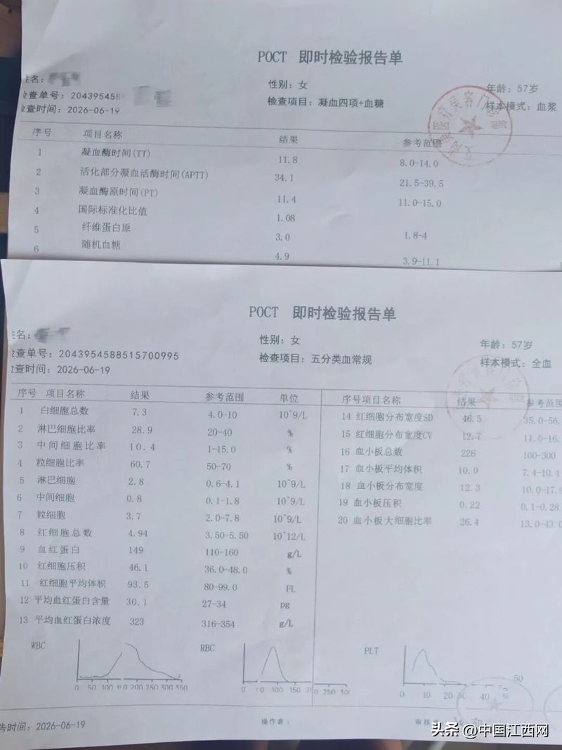 割双眼皮多少钱全隔
