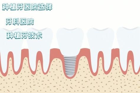 医院美白牙齿多少钱