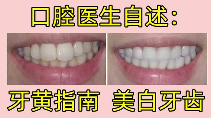 医院美白牙齿多少钱