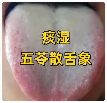 男性肾虚的治疗方法
