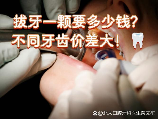 拔牙龈里面的智齿多少钱