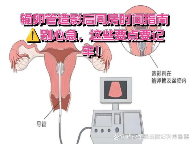 输卵管造影怎么做多少钱