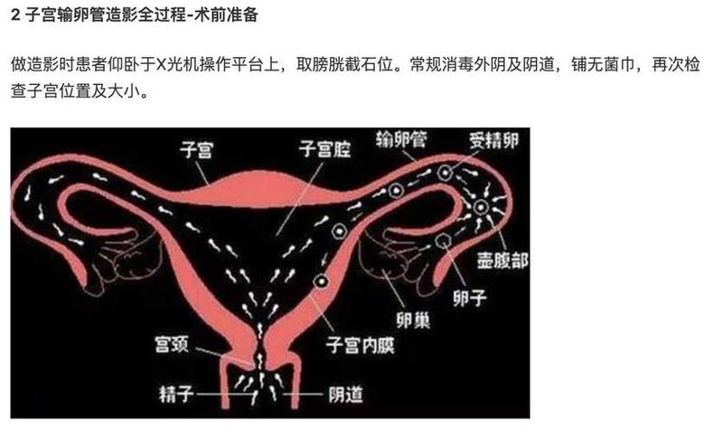 输卵管造影怎么做多少钱