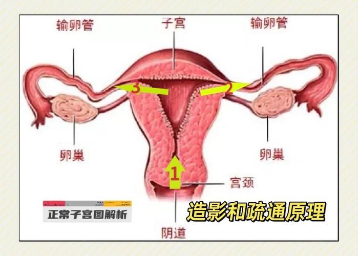 输卵管造影怎么做多少钱
