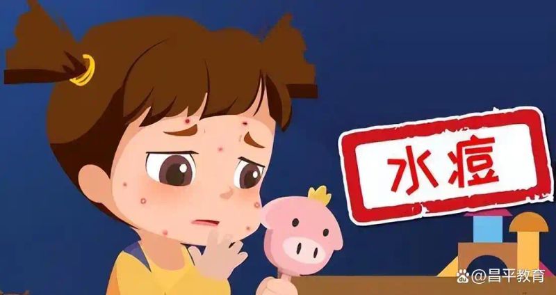关于水痘的治疗方法