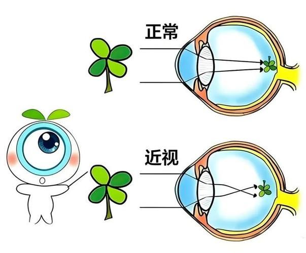幼儿预防近视按摩方法