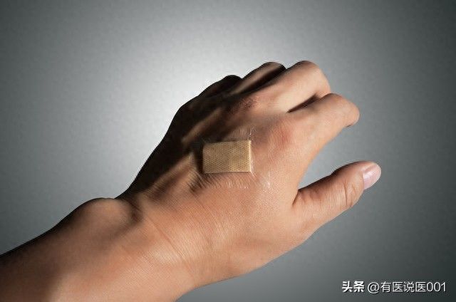 烧伤知识图片