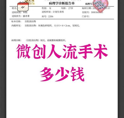 超导式无痛人流多少钱