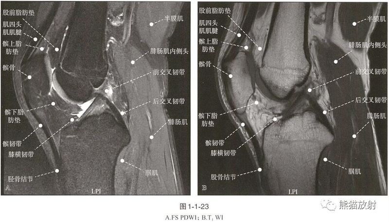 膝关节核磁共振多少钱