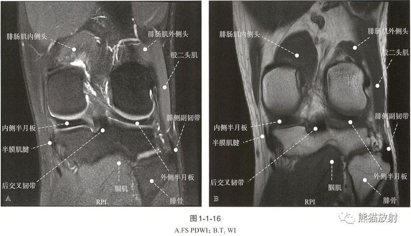 膝关节核磁共振多少钱