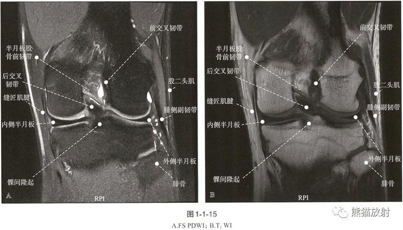 膝关节核磁共振多少钱