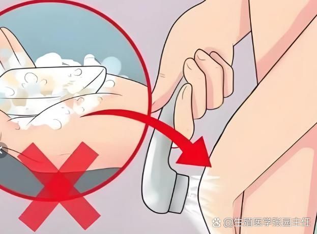 尿道炎的治疗方法