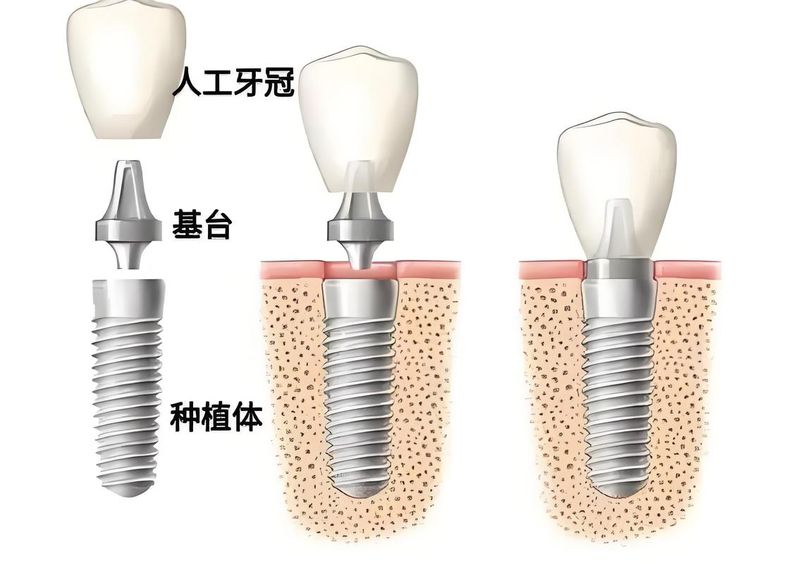 A step map to grow teeth